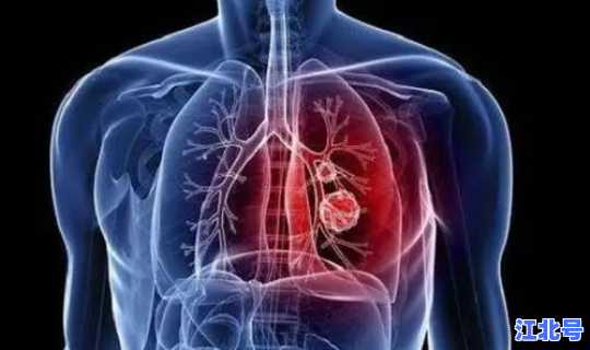 泉州新增一例肺炎是在哪个地方的(福建泉州冠状病毒肺炎最新消息)