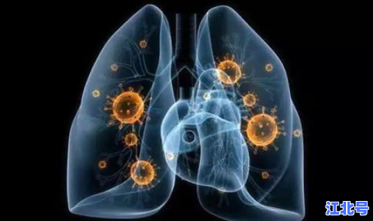 广东新增新型肺炎13例，广东省14例肺炎在哪