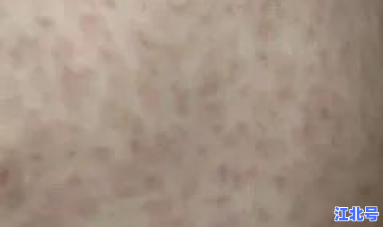 感染新冠的迹象，感染新冠有什么特征