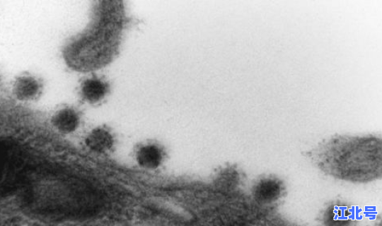 新冠病毒变异德尔塔病毒(冠形病毒)